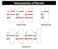 신종 코로나 바이러스 (2019-nCoV) IgM / IgG 항체 콤보 테스트 키트 (콜로이드 골드)